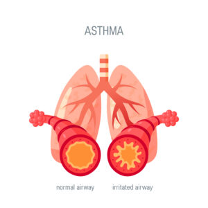 ASTHMA/ALLERGIES