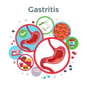 GASTROENTEROLOGICAL CONDITIONS